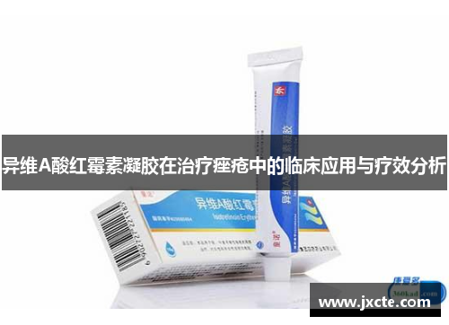 异维A酸红霉素凝胶在治疗痤疮中的临床应用与疗效分析